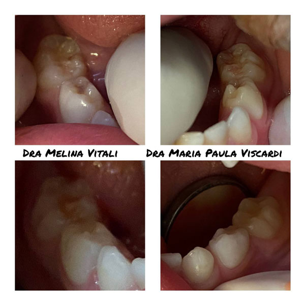 antes-e-depois-5