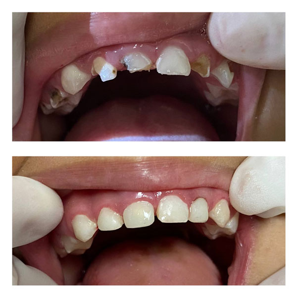 antes-e-depois-6