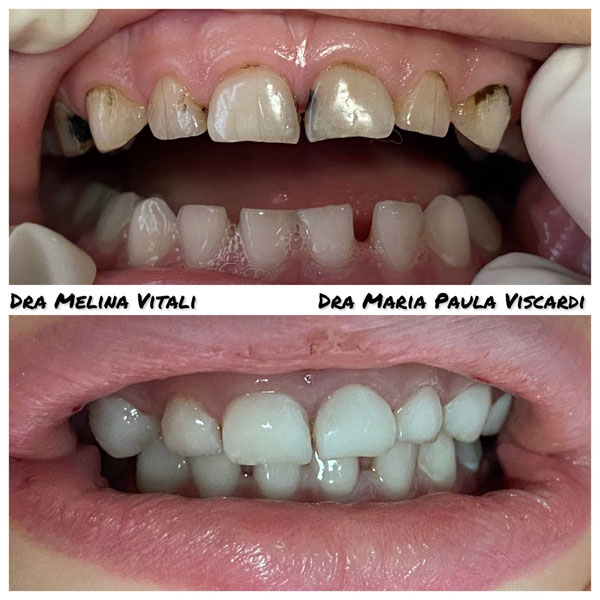 antes-e-depois-7