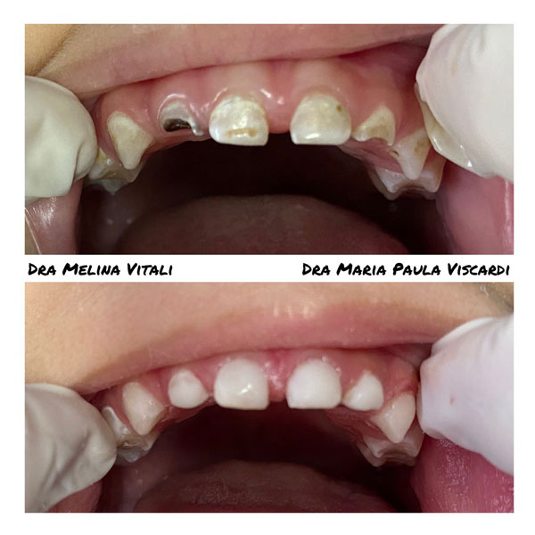 antes-e-depois-8